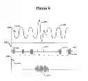 Fig. 09 - System and method to modulate phrenic nerve to prevent sleep apnea