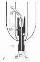 Fig. 02 - Percutaneous gateway, a fixing system for a prosthesis, a fixture and connecting means for signal transmission