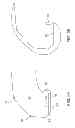 Fig. 06 - Systems and methods for providing a tibial articulation feature