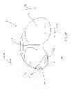 Fig. 09 - Systems and methods for providing a tibial articulation feature