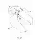 Fig. 40 - Systems and methods for providing a tibial articulation feature
