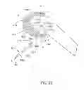 Fig. 41 - Systems and methods for providing a tibial articulation feature