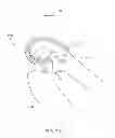 Fig. 43 - Systems and methods for providing a tibial articulation feature
