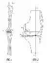 Fig. 02 - System and method for pre-operatively determining desired alignment of a knee joint