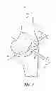 Fig. 03 - System and method for pre-operatively determining desired alignment of a knee joint
