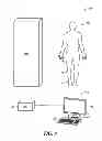 Fig. 06 - System and method for pre-operatively determining desired alignment of a knee joint