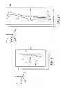 Fig. 07 - System and method for pre-operatively determining desired alignment of a knee joint