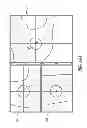 Fig. 11 - System and method for pre-operatively determining desired alignment of a knee joint