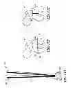 Fig. 16 - System and method for pre-operatively determining desired alignment of a knee joint