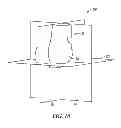 Fig. 17 - System and method for pre-operatively determining desired alignment of a knee joint