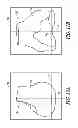 Fig. 18 - System and method for pre-operatively determining desired alignment of a knee joint