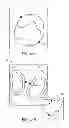 Fig. 19 - System and method for pre-operatively determining desired alignment of a knee joint