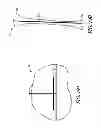 Fig. 20 - System and method for pre-operatively determining desired alignment of a knee joint