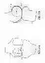 Fig. 24 - System and method for pre-operatively determining desired alignment of a knee joint