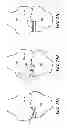 Fig. 25 - System and method for pre-operatively determining desired alignment of a knee joint