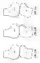 Fig. 26 - System and method for pre-operatively determining desired alignment of a knee joint