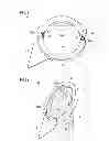 Fig. 02 - Belt detachment preventing jig