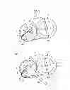 Fig. 05 - Belt detachment preventing jig