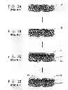 Fig. 03 - METHOD FOR PRODUCING METALIZED FIBROUS COMPOSITE SHEET WITH OLEFIN COATING