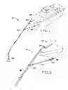 Fig. 02 - Device for anchoring a boat