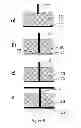 Fig. 06 - Electrophoresis gel assembly