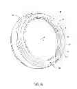 Fig. 07 - PRESSURE RELIEF VENTING FOR A VALVE DISK SEAL