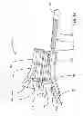 Fig. 13 - Consumable assembly for use in extrusion-based layered deposition systems