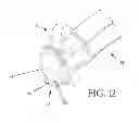 Fig. 08 - INTEGRATED POLE-TO-SKI-COUPLING ARRANGMENT