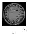 Fig. 06 - Inspection of defects in a contact lens