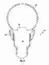 Fig. 03 - LED lighting using spectral notching