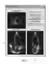 Fig. 06 - EVALUATION SYSTEM FOR DETERMINATION OF CARDIOVASCULAR FUNCTION PARAMETERS USING ULTRASOUND IMAGES