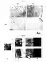 Fig. 05 - METHOD OF MANUFACTURING A SCAFFOLD FOR TISSUE ENGINEERING OR REPAIR