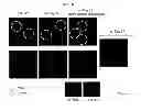 Fig. 18 - METHOD OF MANUFACTURING A SCAFFOLD FOR TISSUE ENGINEERING OR REPAIR