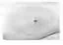 Fig. 01 - Methods for promoting hair growth