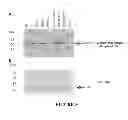 Fig. 04 - CONSTRAINED IMMUNOGENIC COMPOSITIONS AND USES THEREFOR