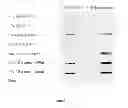 Fig. 10 - Proteins that bind PI16 and uses thereof