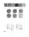 Fig. 06 - PHOSPHORYLATED TWIST1 AND METASTASIS