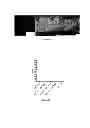Fig. 07 - Therapeutic use of neural stem cells