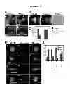 Fig. 06 - Compositions and Methods for Enhancing Dendritic Cell Resistance to Bacterial Infection and for Enhancing the Mobility of Dendritic Cells for Dendritic Cell-Based Immunotherapy