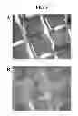 Fig. 07 - POROUS METALLIC STRUCTURES