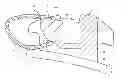 Fig. 01 - Orthodontic bracket