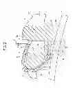 Fig. 03 - Orthodontic bracket