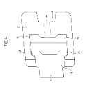 Fig. 05 - Orthodontic bracket
