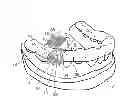 Fig. 01 - Surgical guide preparation tool and method for preparing surgical guide