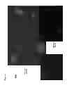 Fig. 06 - COMPOSITIONS AND METHODS FOR DETECTING VIRAL INFECTION USING DIRECT-LABEL FLUORESCENCE IN SITU HYBRIDIZATION