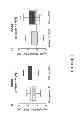 Fig. 02 - METHODS AND KITS FOR THE DIAGNOSIS OF PROSTATE CANCER