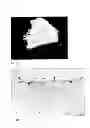 Fig. 11 - Chimeric avian-based screening system containing mammalian grafts