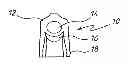 Fig. 01 - Safety Device and Inflating Apparatus Therefor