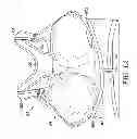 Fig. 02 - Post-surgical garment