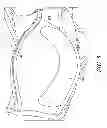 Fig. 07 - Post-surgical garment